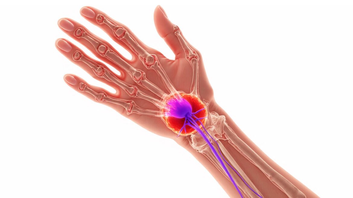 5 Surprising Health Issues Acupuncture Can Address