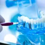 Dental