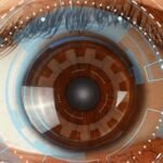 Thinking About LASIK Laser Surgery